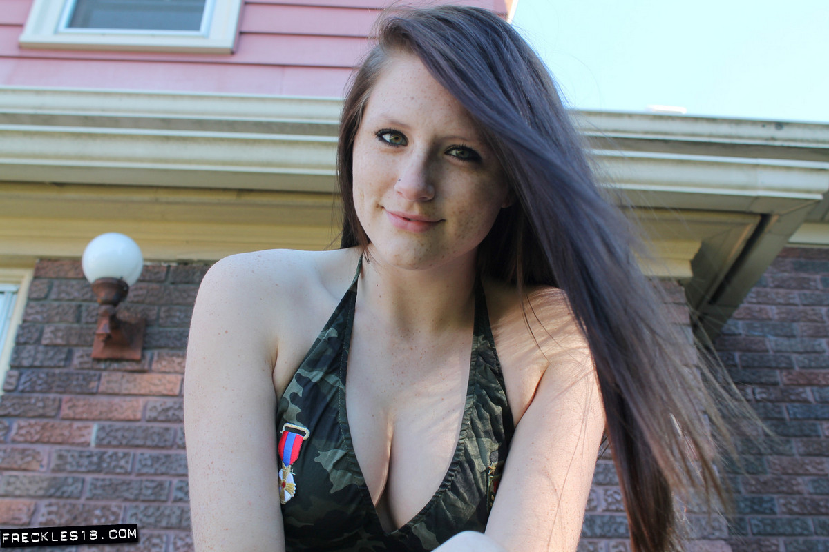 Freckles18