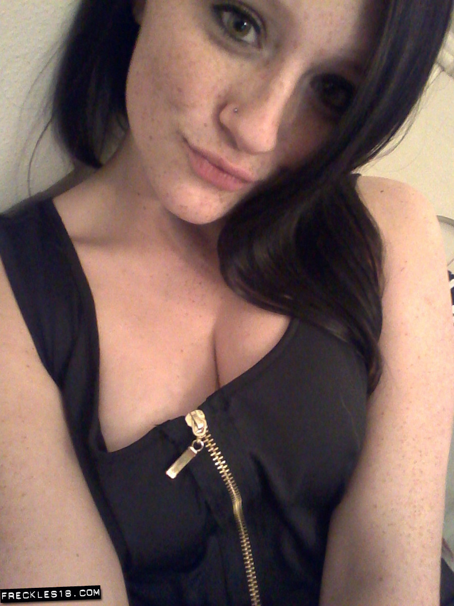 Freckles18