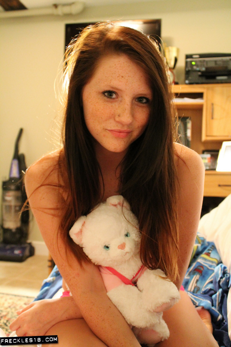 Freckles18