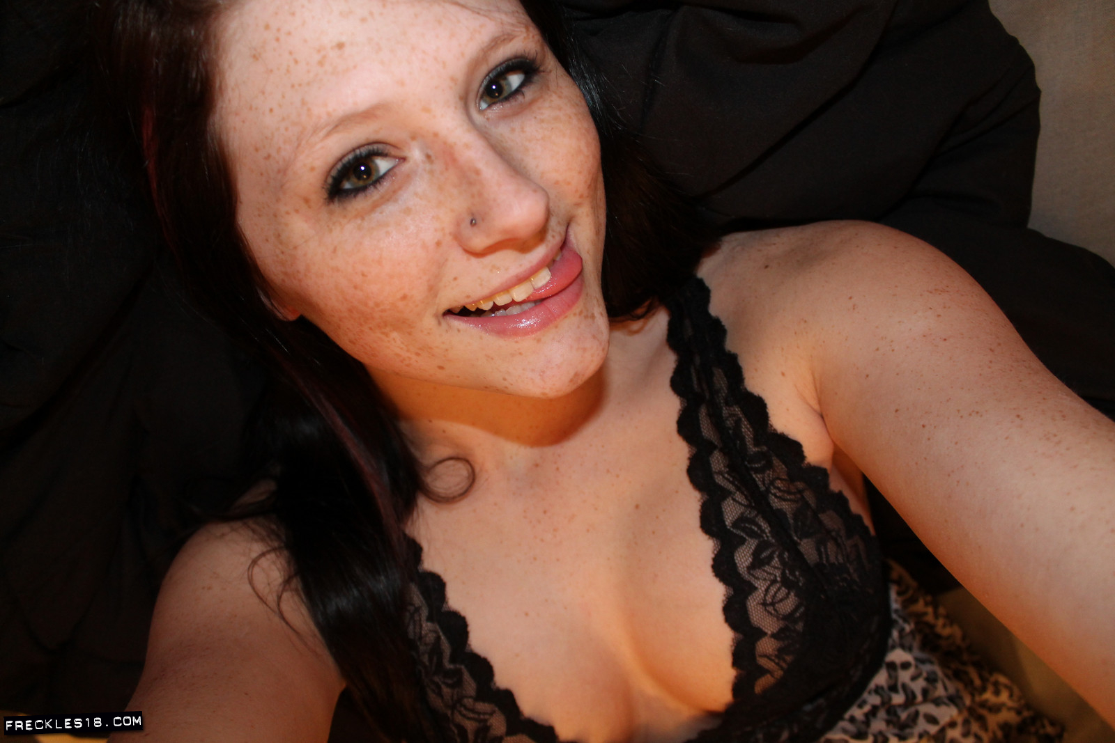 Freckles18