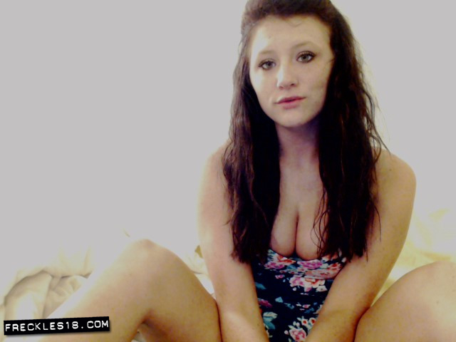 Freckles18