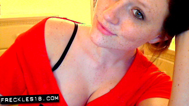 Freckles18