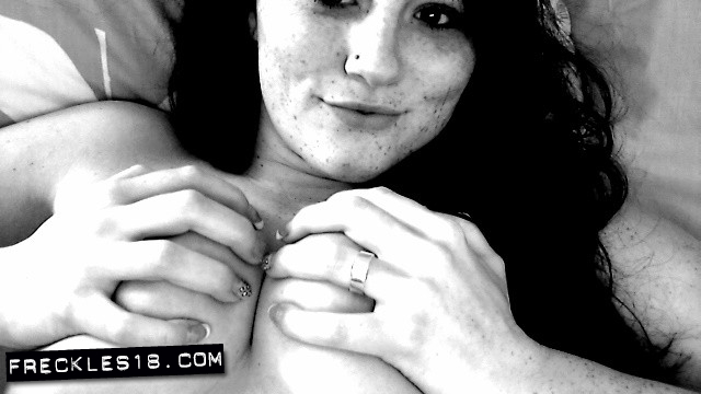 Freckles18