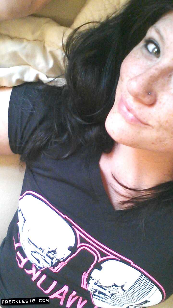 Freckles18