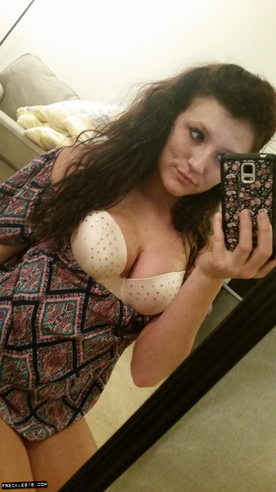 Freckles18