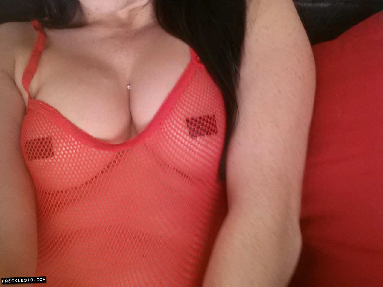 Freckles18