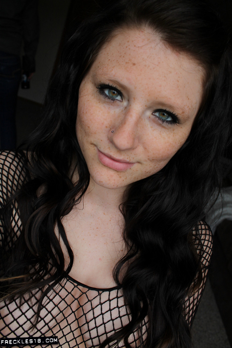 Freckles18