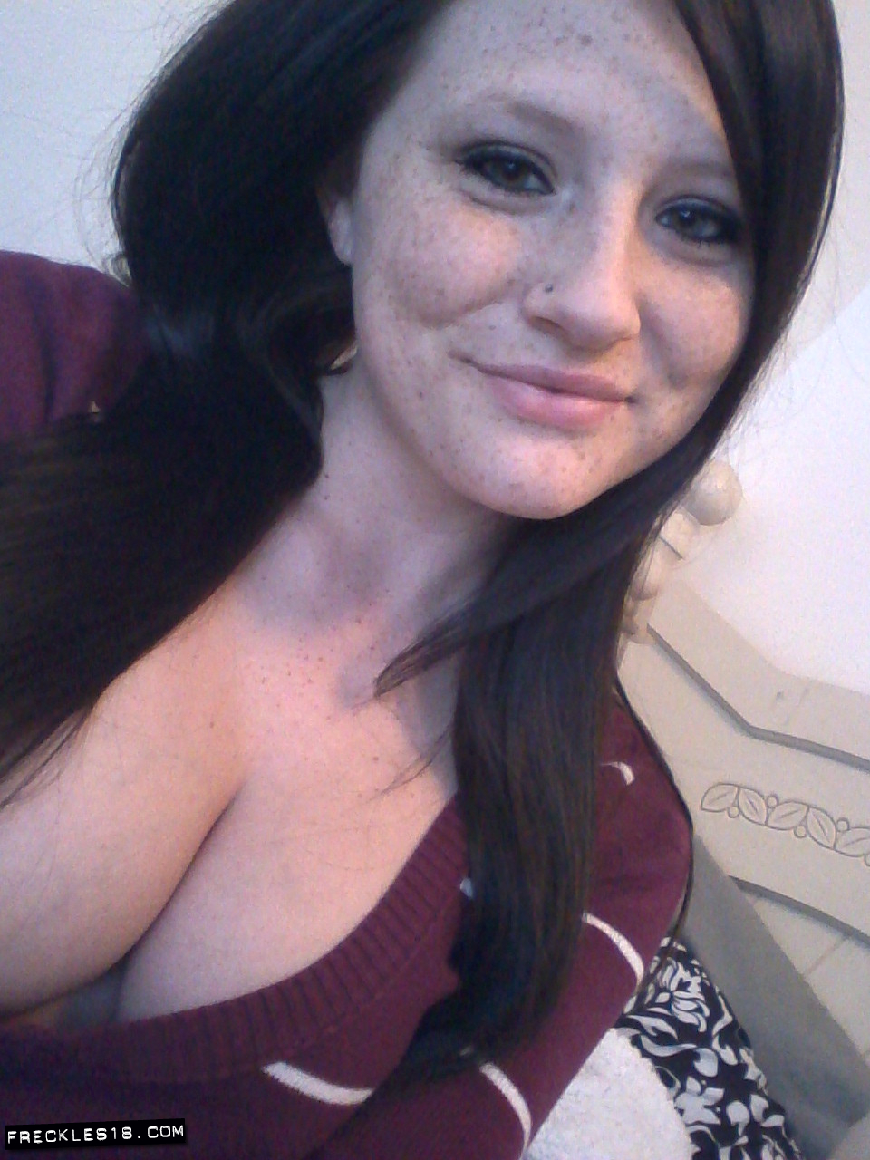Freckles18
