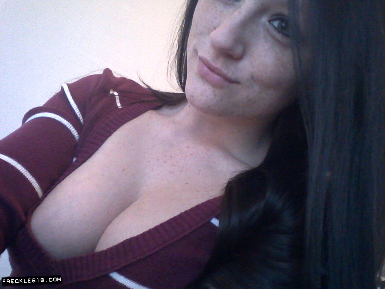 Freckles18