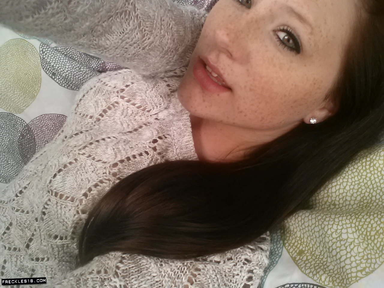 Freckles18