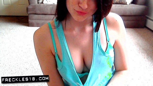 Freckles18