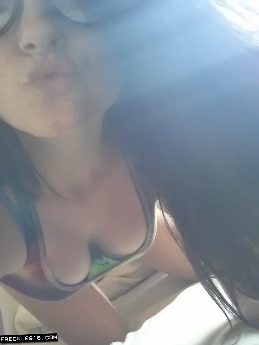 Freckles18