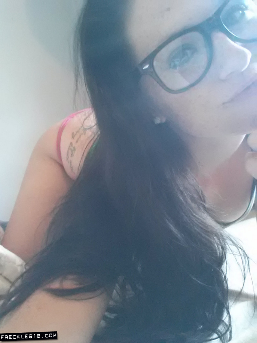 Freckles18