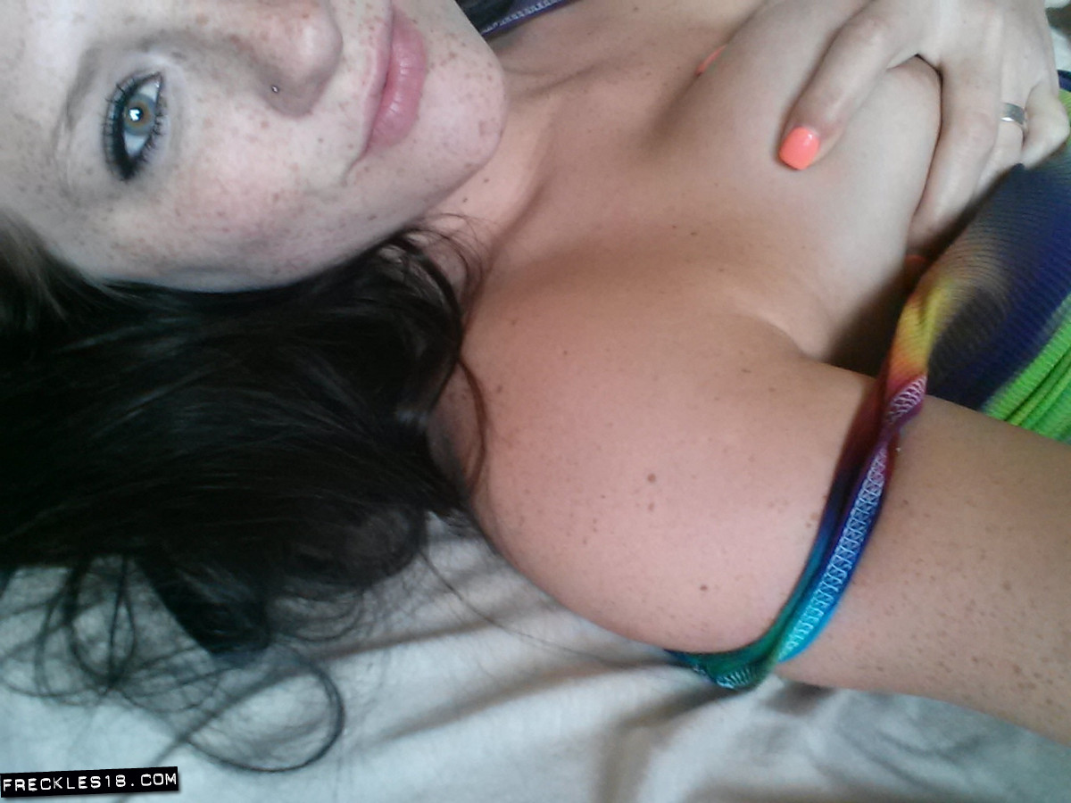 Freckles18