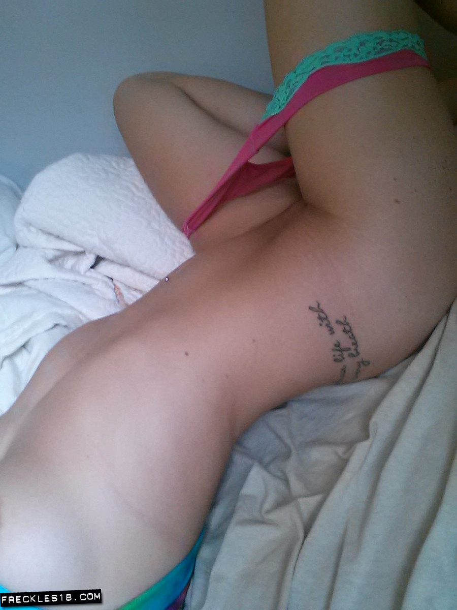 Freckles18